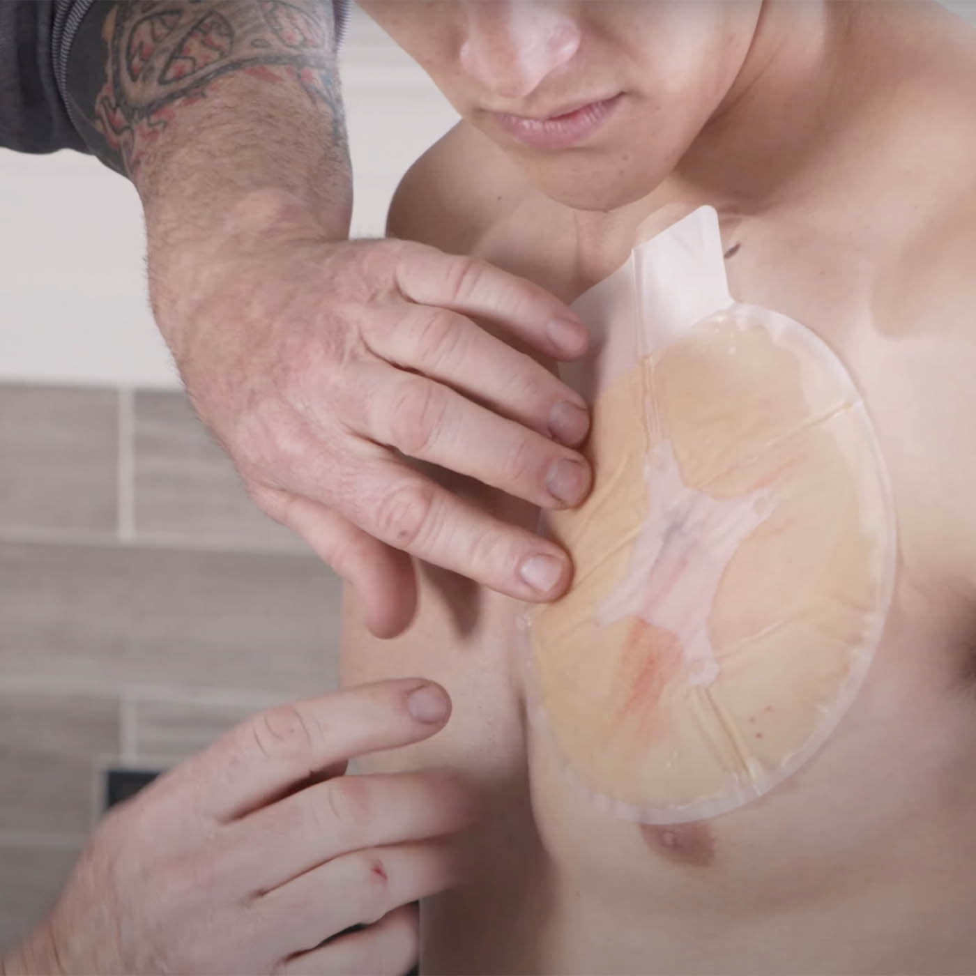 Chest Seal | Versenkt
